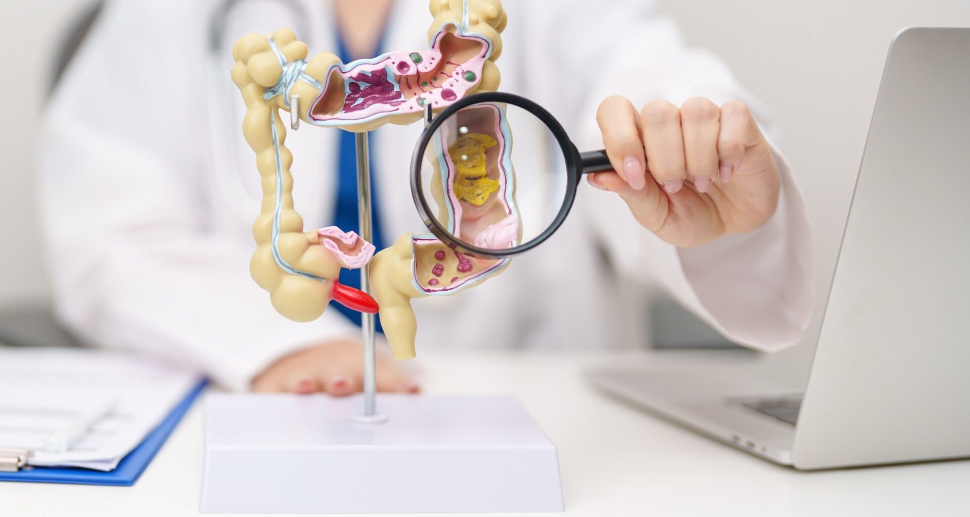 Physician holding magnifying glass to 3D colon model.