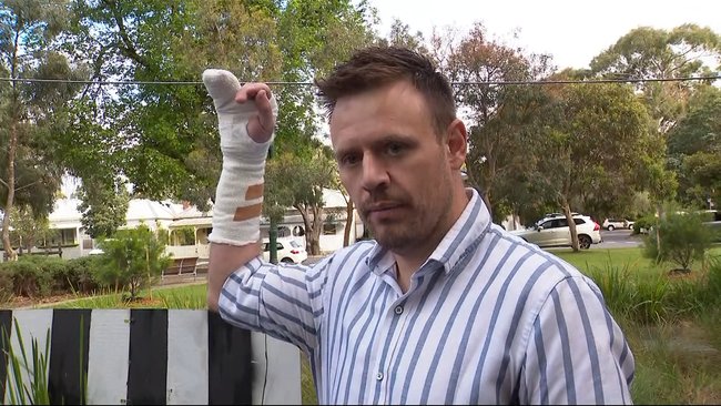 Shoppee suffered a broken hand during the confrontation. 