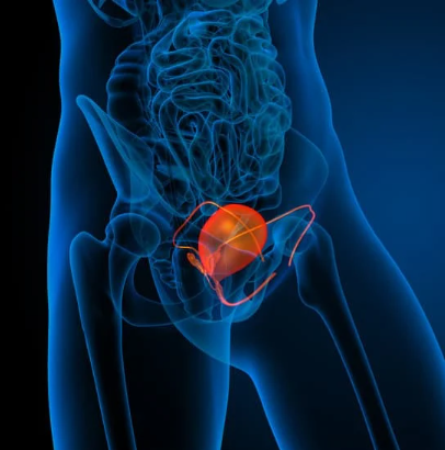 In the phase 3 NRG-CC009 trial, SRS led to longer overall survival vs HA-WBRT plus memantine with similar neurocognitive failure in SCLC brain metastases.