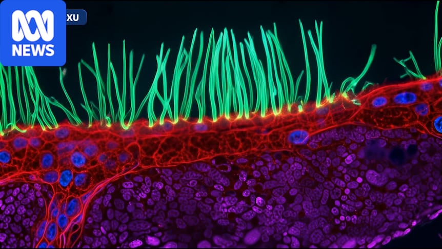 Winner of Nikon's Small World In Motion competition was AI generated