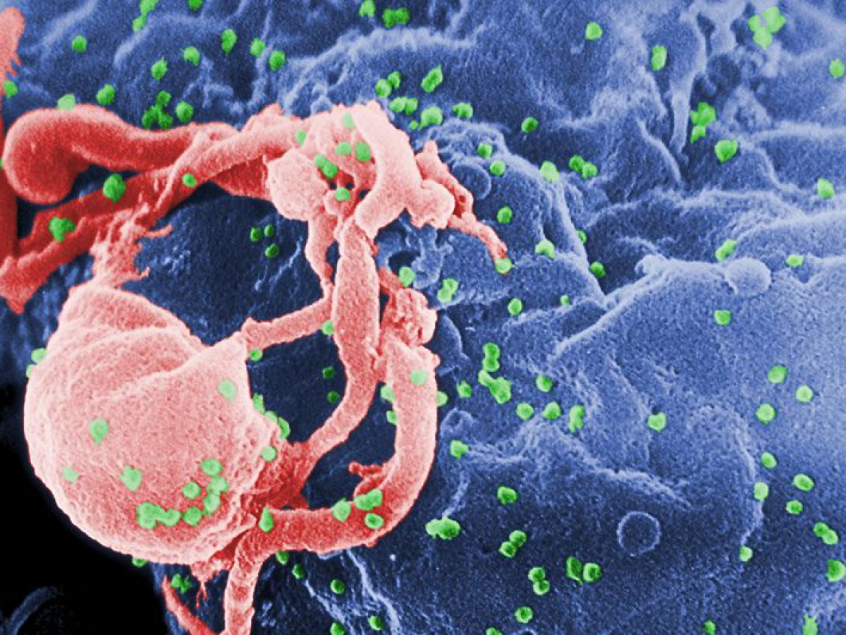 1 person in 60 has HIV in Fiji: national emergency declared