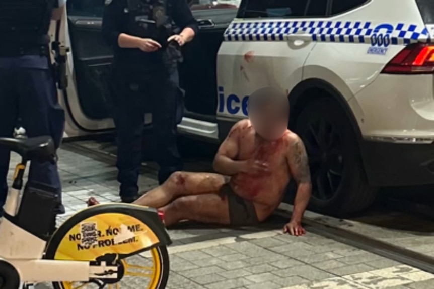 A man shirtless on the floor next to a police vehicle