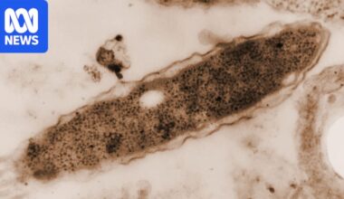 Legionnaires' disease was uncovered 50 years ago but mystery still remains