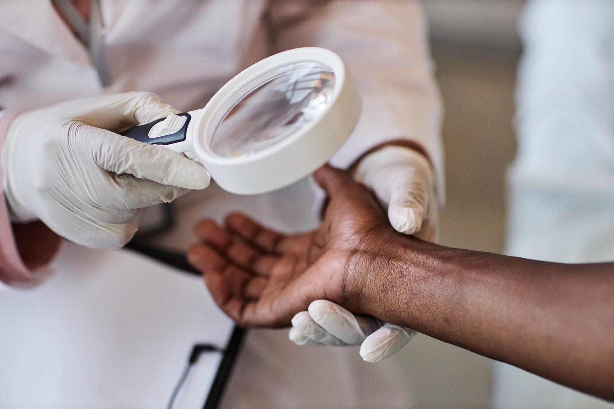 Clinician looking at skin of African American individual