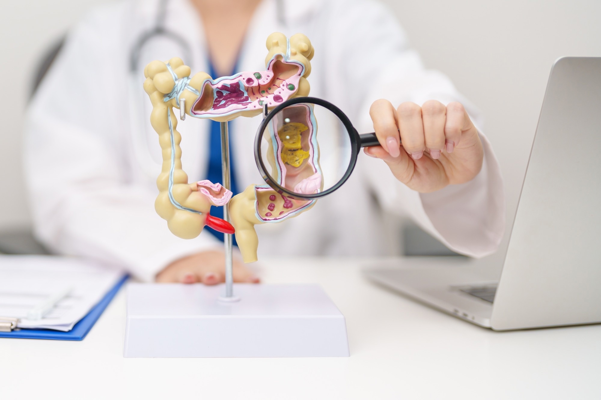 Physician holding magnifying glass to 3D colon model.