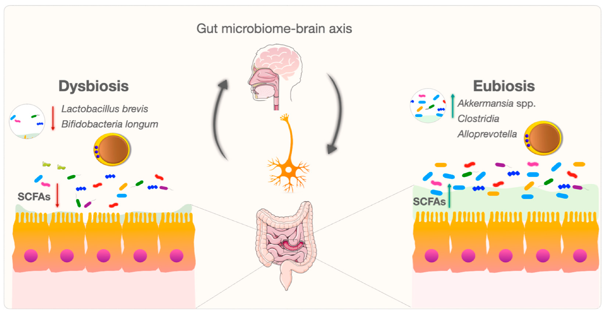 Gut microbiome–brain axis in dysbiosis and eubiosis. Schematic illustrating differences in intestinal microbial composition and short-chain fatty acid (SCFA) production between dysbiosis and eubiosis, highlighting bacterial groups associated with gut health and their potential influence on gut–brain communication. These interactions provide context for investigating the possible role of Blastocystis in microbiome regulation and host health. Image credit: Aykur et al. (2024) Diagram illustrating the gut–brain axis, contrasting dysbiosis with reduced beneficial bacteria and short-chain fatty acids against eubiosis with greater microbial diversity and metabolite production.