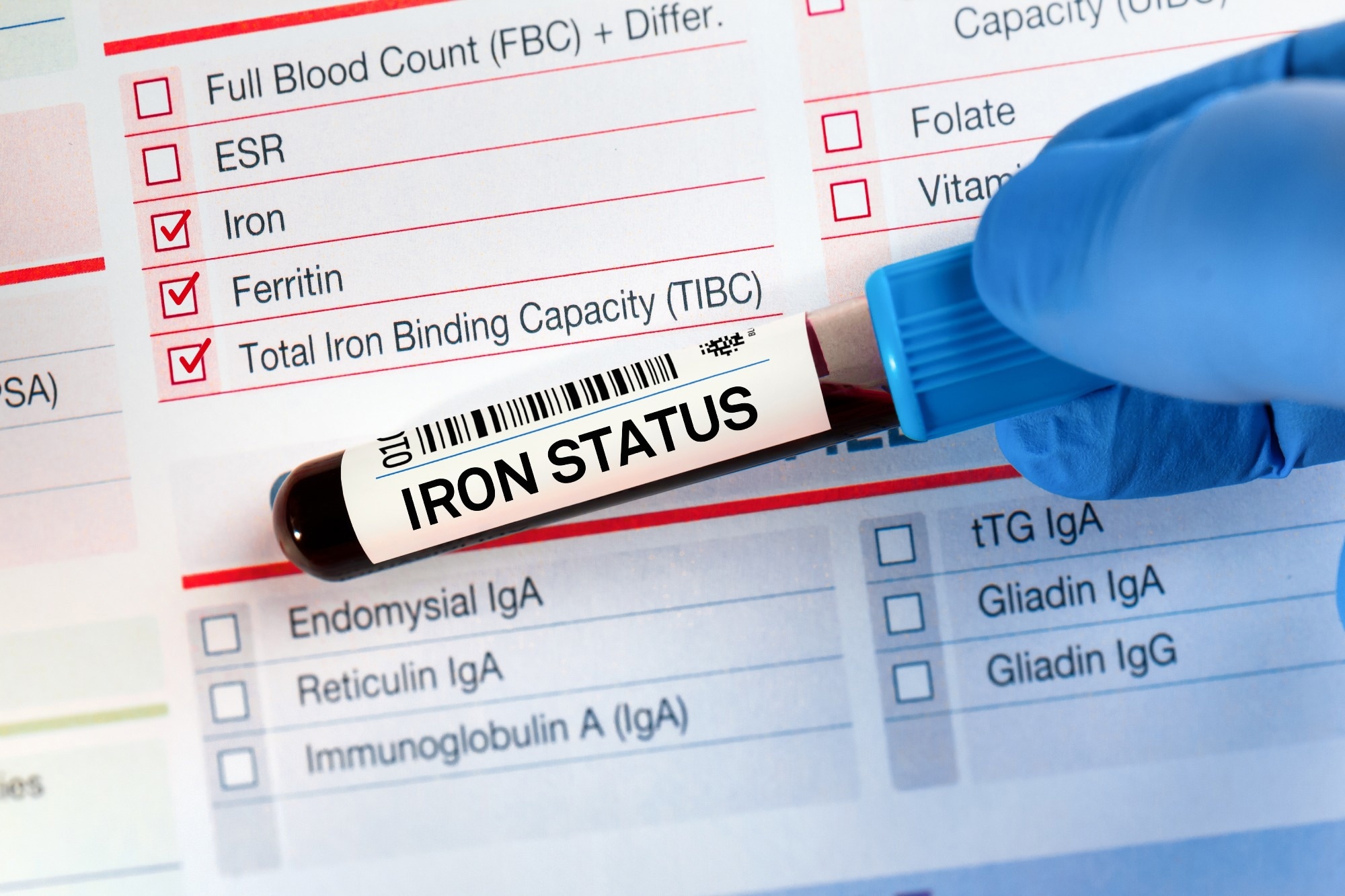 Blood sample tube for analysis of Iron Status Tests. Blood tube test with requisition form for Iron status Test