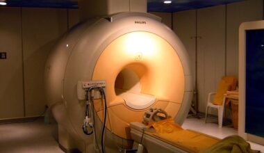 New iron contrast agent offers safer cardiac MRI scans