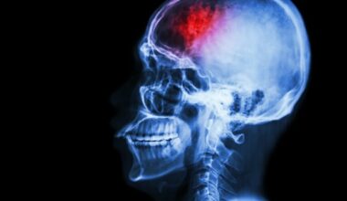 Review highlights essential neurological considerations for gender dysphoria care
