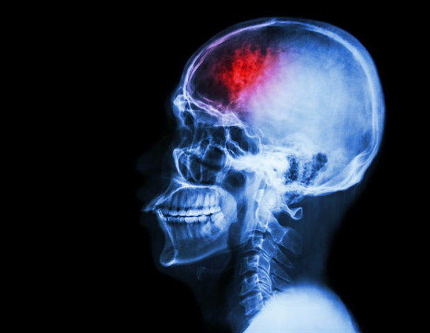 Review highlights essential neurological considerations for gender dysphoria care