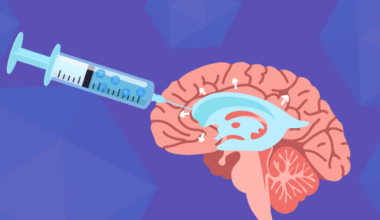 Gene Therapy Could Treat Hydrocephalus Without Invasive Brain Surgery