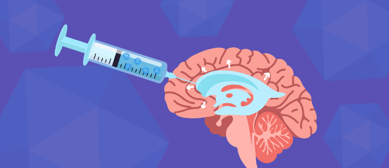 Gene Therapy Could Treat Hydrocephalus Without Invasive Brain Surgery