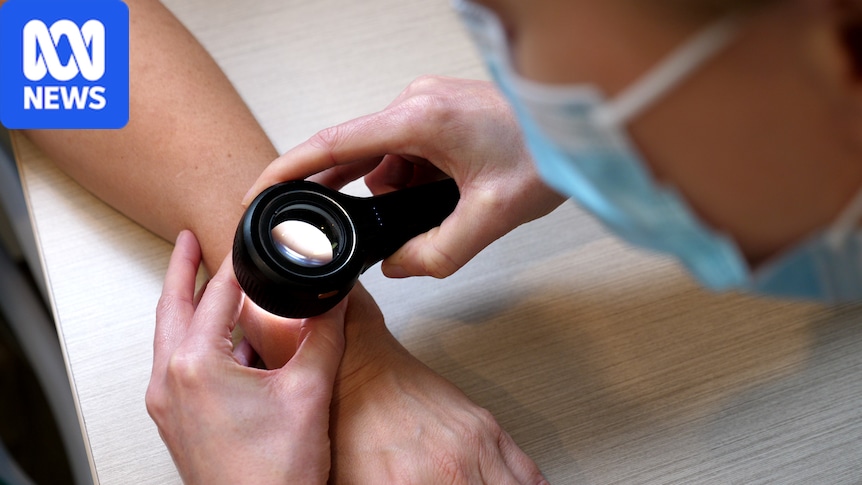 Melanoma vaccine trial results 'phenomenal', researcher says