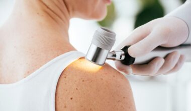 Study helps unravel melanoma mystery