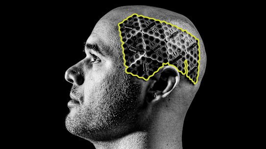 Fluent research participant Lachlan Hill wears an electrode array that can match brain activity to basic phrases.
