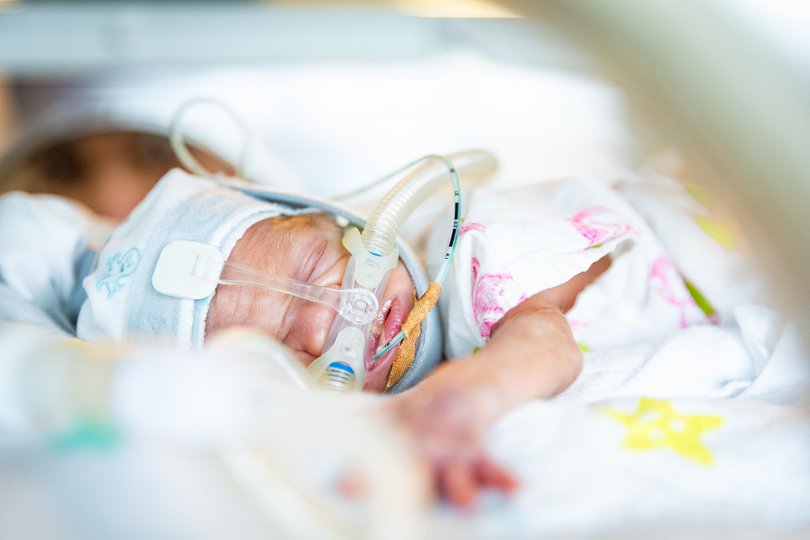 Sofia Bourke was born at 25 weeks and is now 3 weeks old.