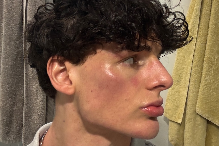 Young man square jaw