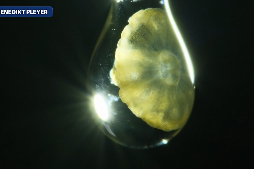 Microscopic image of jellyfish larvae suspended in water droplet.
