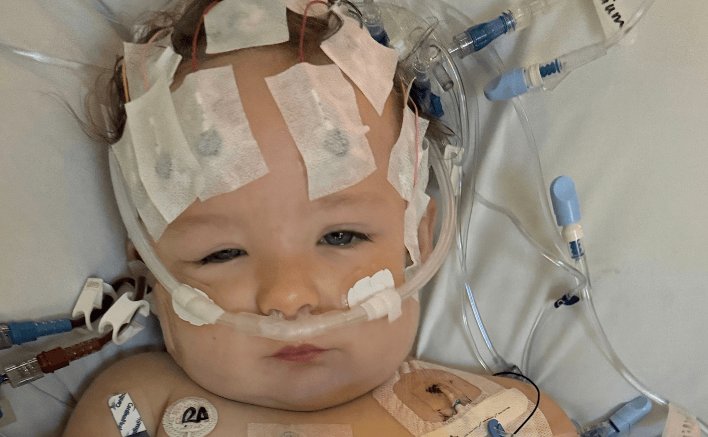 How Raw Milk Made This Toddler Dangerously Ill