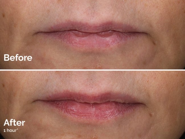 Before and after pictures show how well it works.