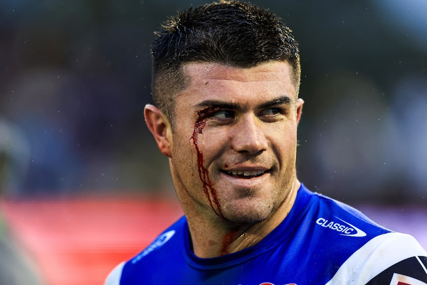 A dark-haired rugby league player smiles as blood runs down his face from the corner of his eye.