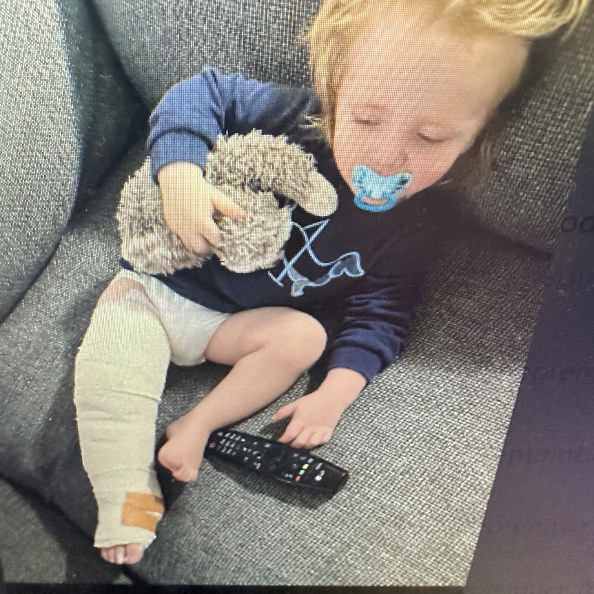 A small boy with his leg bandaged sits on a couch, holding a soft toy and with a dummy in his mouth.