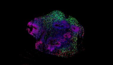 How Anesthesia Affects Neural Activity