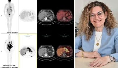 ccRCC kidney cancer: PET/CT imaging approach improves lesion detection • healthcare-in-europe.com