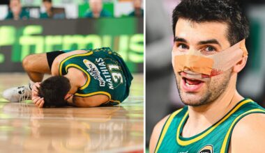 Fans hail ‘warrior’ Dakota Mathias after he plays on with blood nose