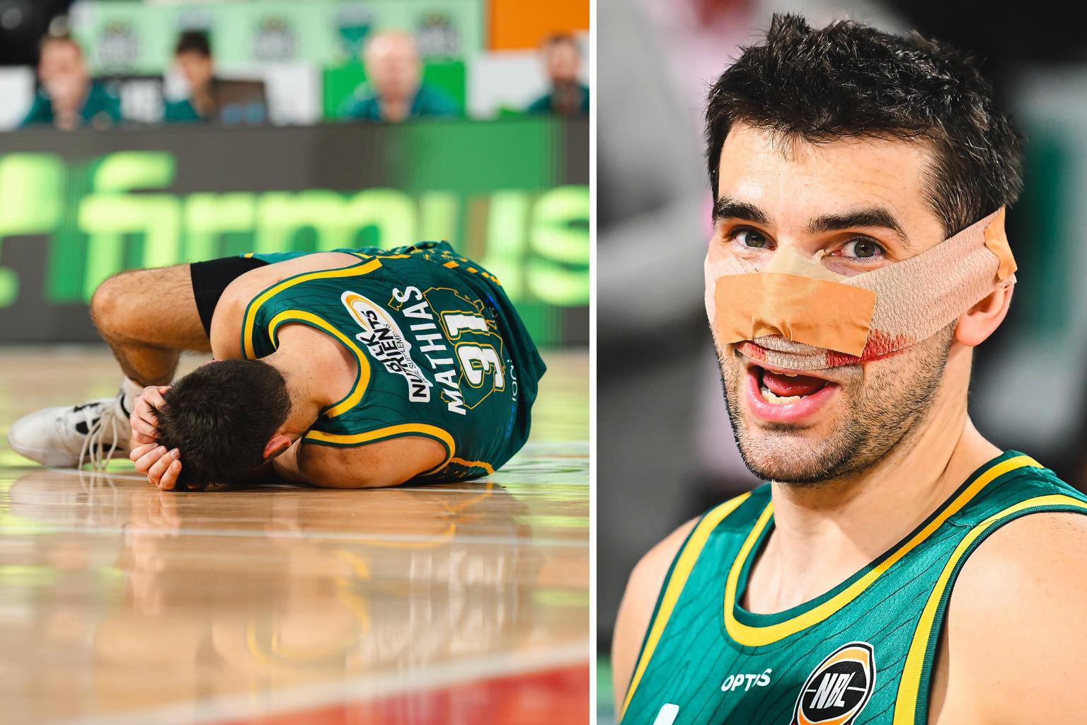 Fans hail ‘warrior’ Dakota Mathias after he plays on with blood nose