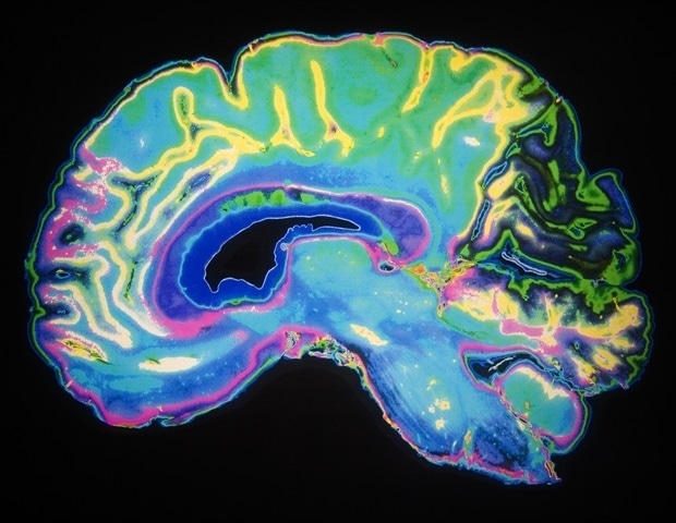 New study identifies genes that shape human brain features
