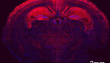 Widespread of transfected cells in the brain by in utero delivery Cre mRNA