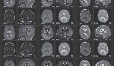 Emma’s Gene - Life Sciences | Weizmann Wonder Wander