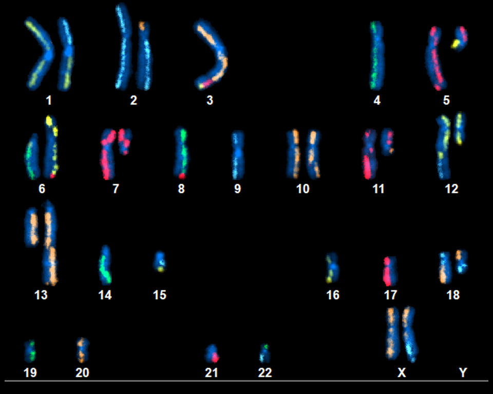 An image showing 22 pairs of numbered and color-coded chromosomes on a black background.
