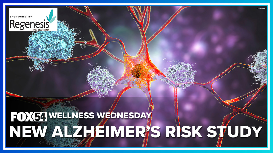 Study explores genetics and lifestyle in Alzheimer's risk
