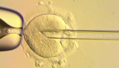 Mitochondrial disease: Healthy babies born in Britain after scientists used DNA from three people to avoid genetic disease