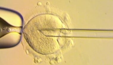 Healthy babies born in Britain after scientists used DNA from three people to avoid genetic disease