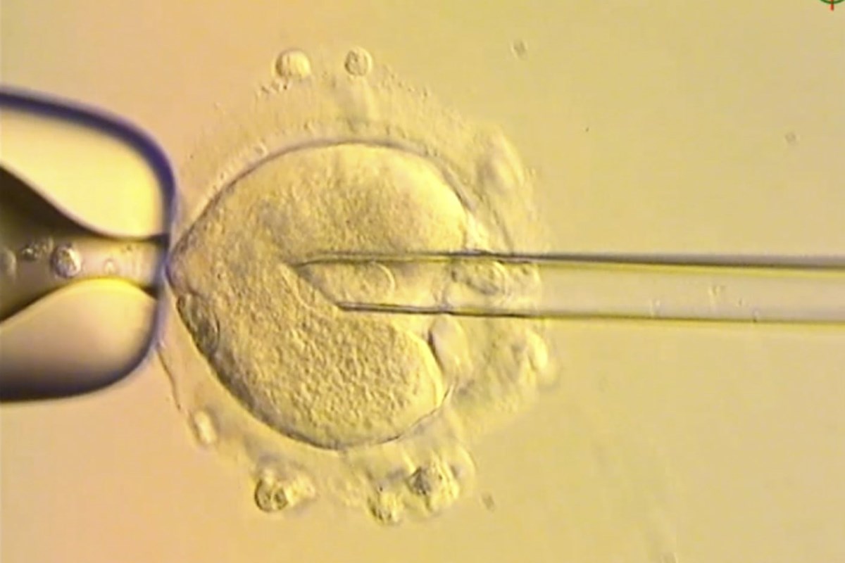 Healthy babies born in Britain after scientists used DNA from three people to avoid genetic disease