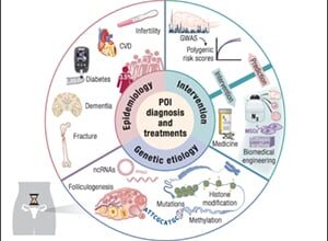 Epidemiology, Genetic Etiology, and Intervention of Premature Ovarian Insufficiency