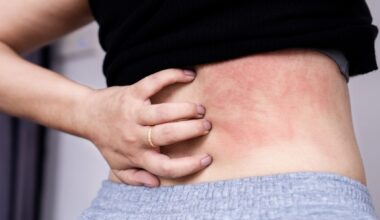 Social Card Image Featured