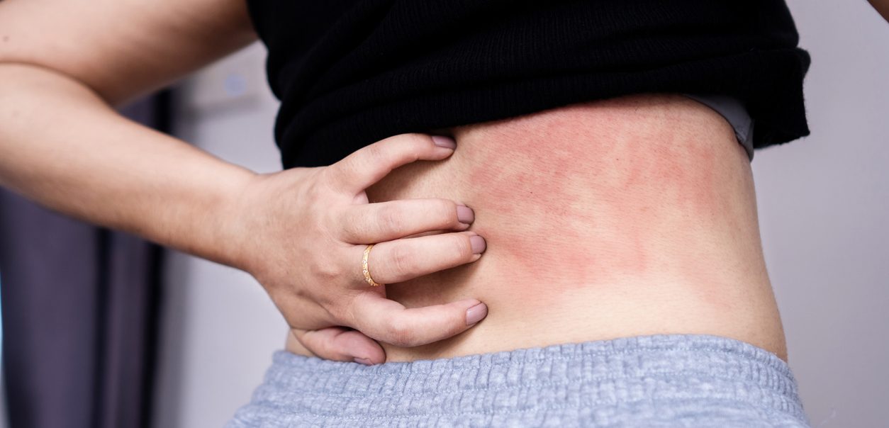 Social Card Image Featured