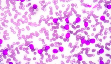 Phase I trial illustrates safer stem cell transplant for genetic disease