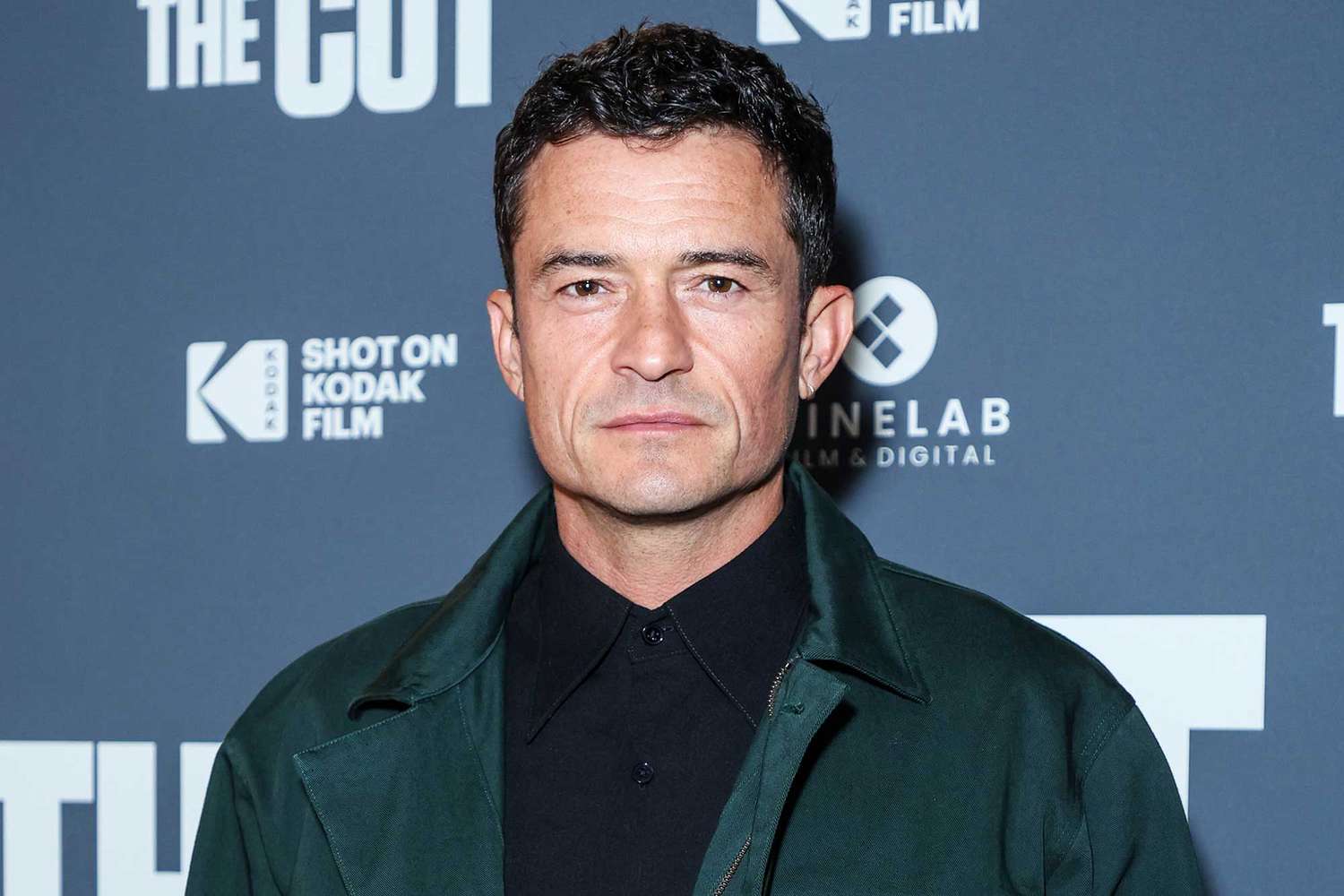 Orlando Bloom says he was horrible to be around while losing 52 pounds for movie