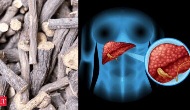 Who should avoid giloy - Giloy: The 'most dangerous' Ayurvedic herb? Top hepatologist warns it can harm your liver