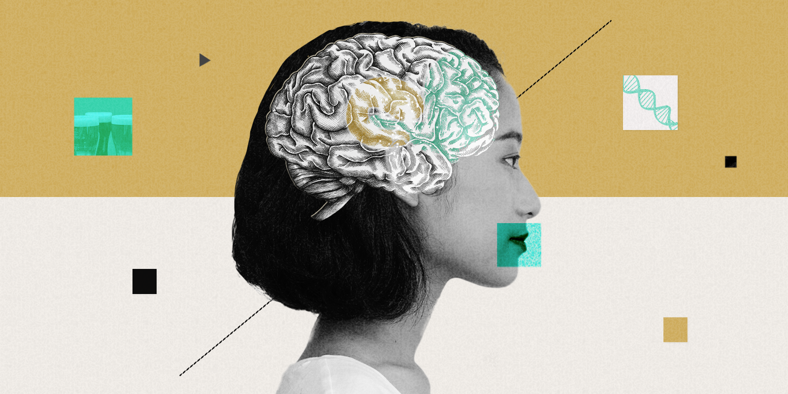 What Do We Really Know About Genetics and Alcohol Use Disorder?