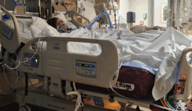 Mom nearly died after catching flesh-eating bacteria on the beach