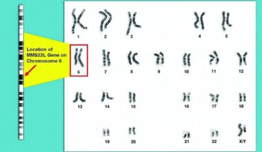 Study Suggests Genetic Mutation in Some Ashkenazi Jewish Men May Be Linked To Higher Prostate Cancer Risk | News