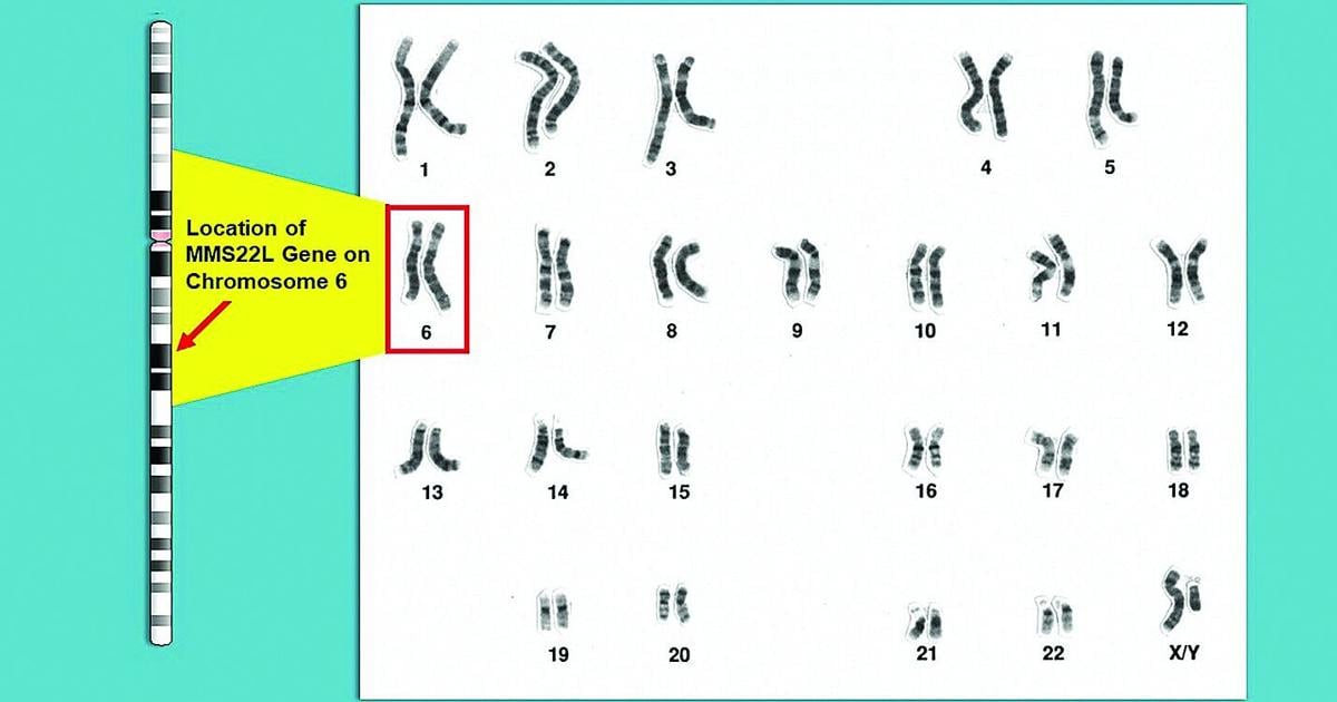 Study Suggests Genetic Mutation in Some Ashkenazi Jewish Men May Be Linked To Higher Prostate Cancer Risk | News