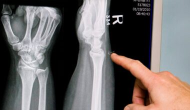 Microplastics detected in human bone marrow; study examines health impacts - CTV News