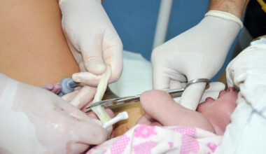 Doctor banned from giving experimental stem cell treatment